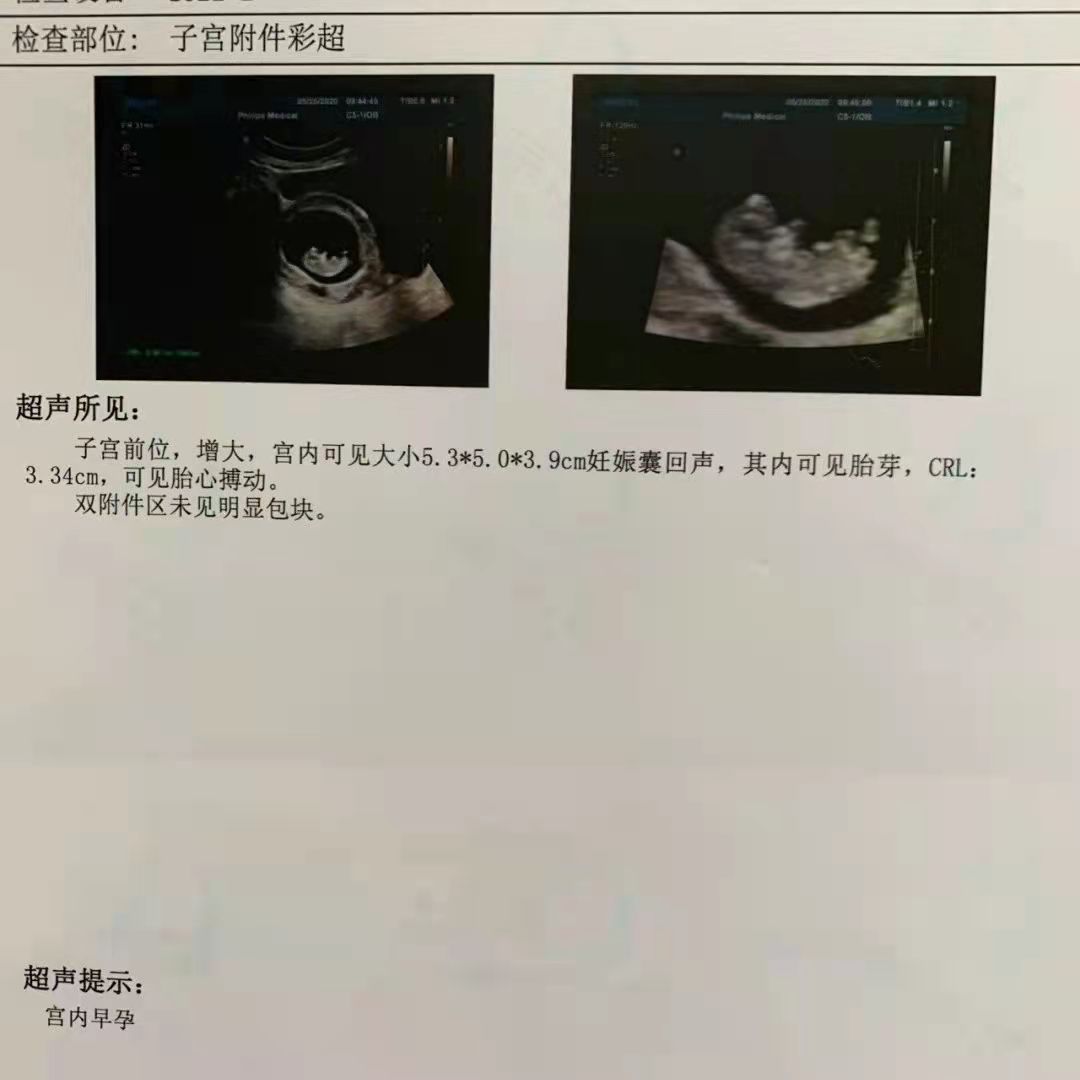 北京捐卵助孕
